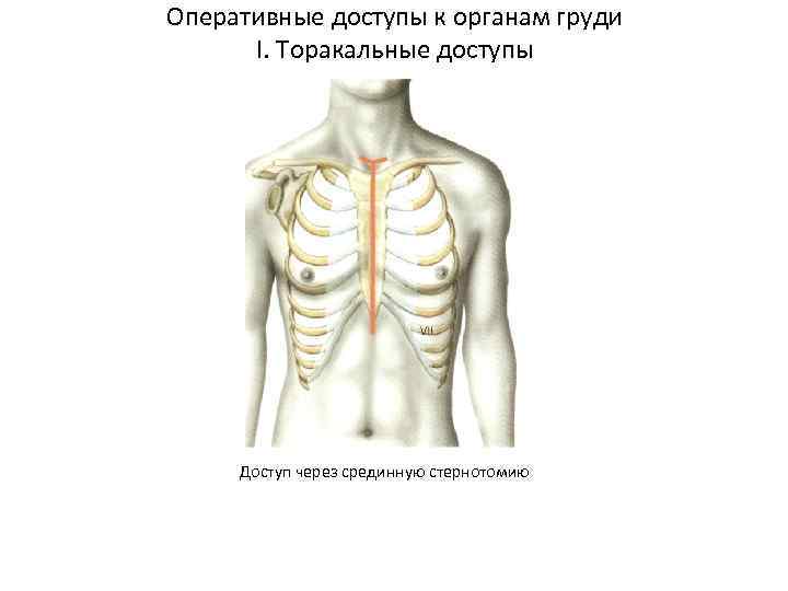 Оперативные доступы к органам груди I. Торакальные доступы Доступ через срединную стернотомию 