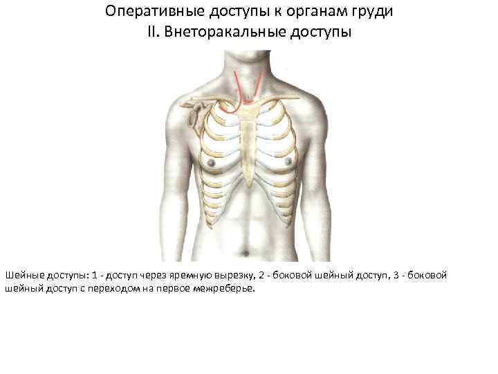 Оперативные доступы к органам груди II. Внеторакальные доступы Шейные доступы: 1 - доступ через