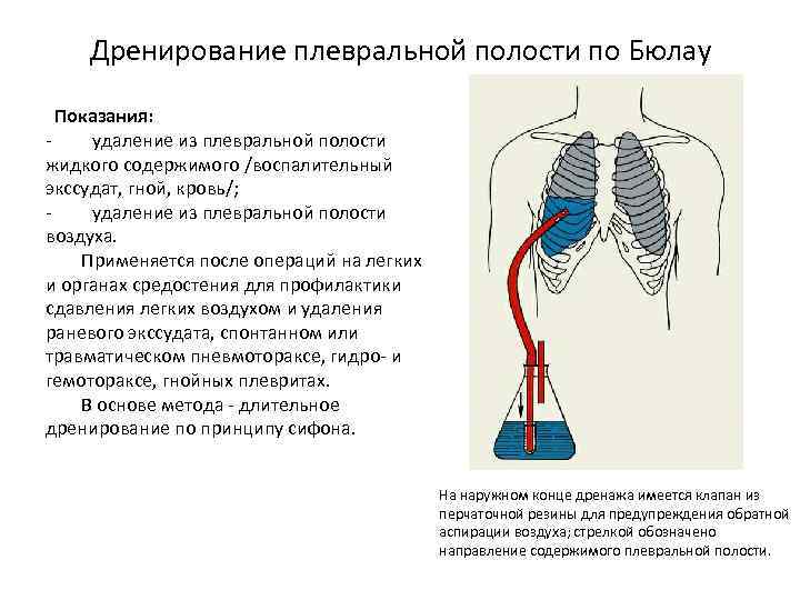 Плевральная полость где находится фото на человеке