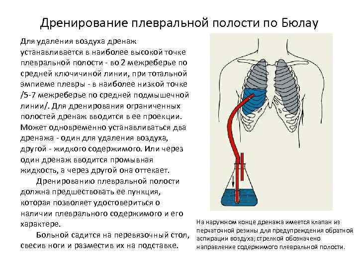 Как прощупать грудные железы самостоятельно фото