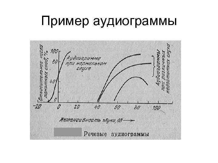 Пример аудиограммы 