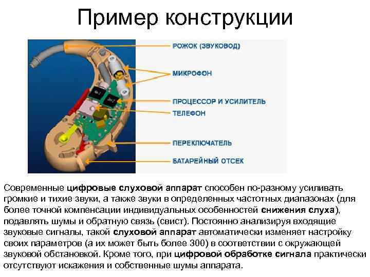 Пример конструкции Современные цифровые слуховой аппарат способен по-разному усиливать громкие и тихие звуки, а