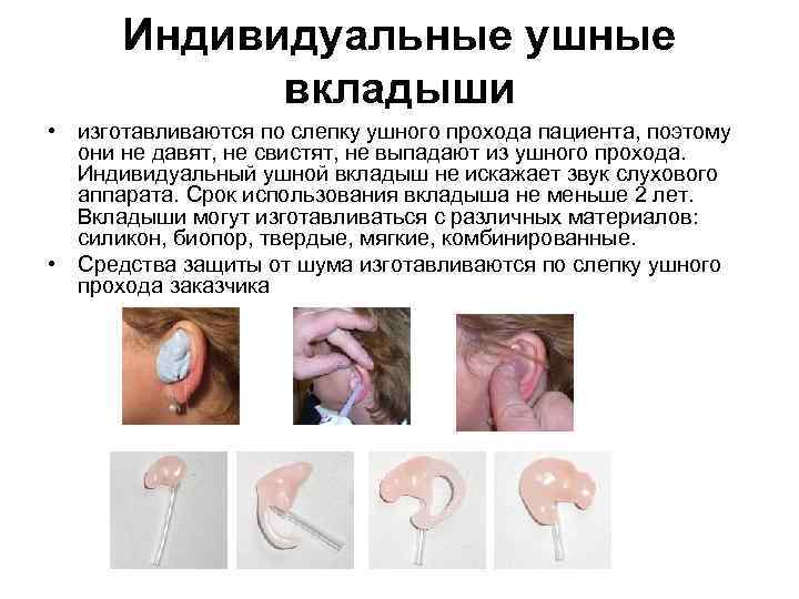 Индивидуальные ушные вкладыши • изготавливаются по слепку ушного прохода пациента, поэтому они не давят,