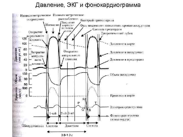 Ли экг. Давление кардиограмма. ЭКГ давление. Напор ЭКГ. Тоны сердца на ЭКГ.