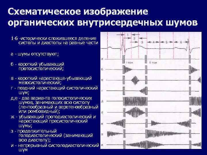 Шумы сердца пропедевтика презентация