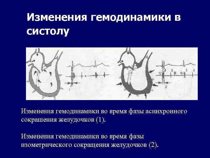 Изменения гемодинамики в систолу Изменения гемодинамики во время фазы асинхронного сокрашения желудочков (1). Изменения