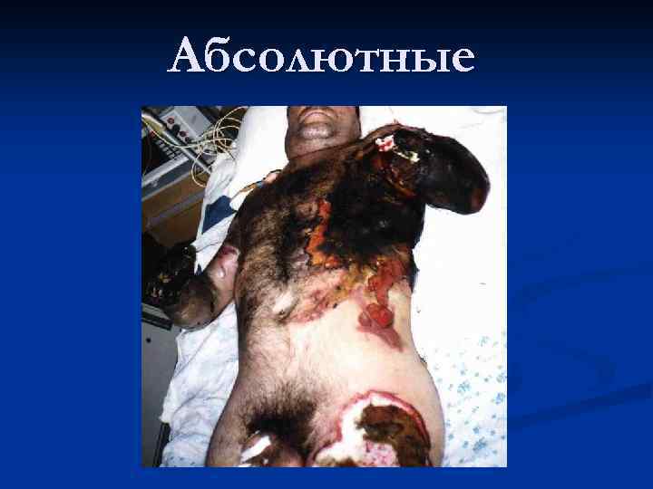 Абсолютные 