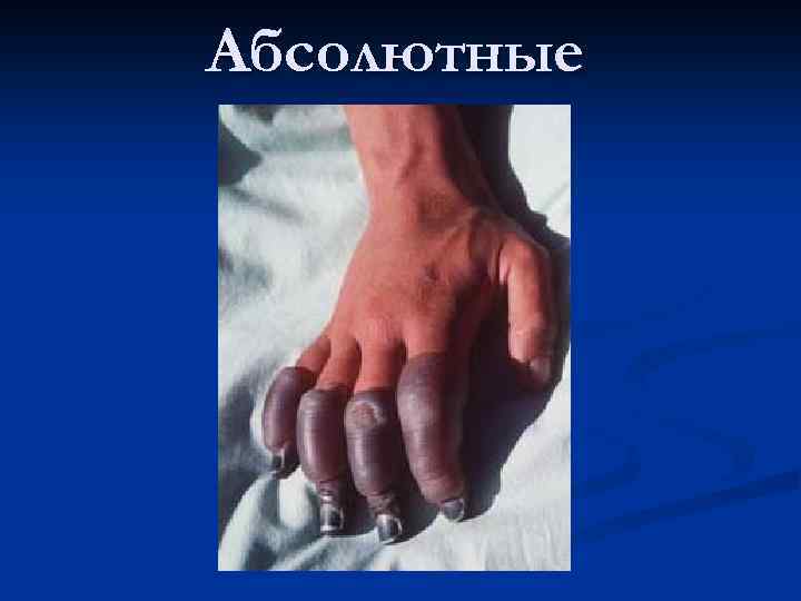 Абсолютные 