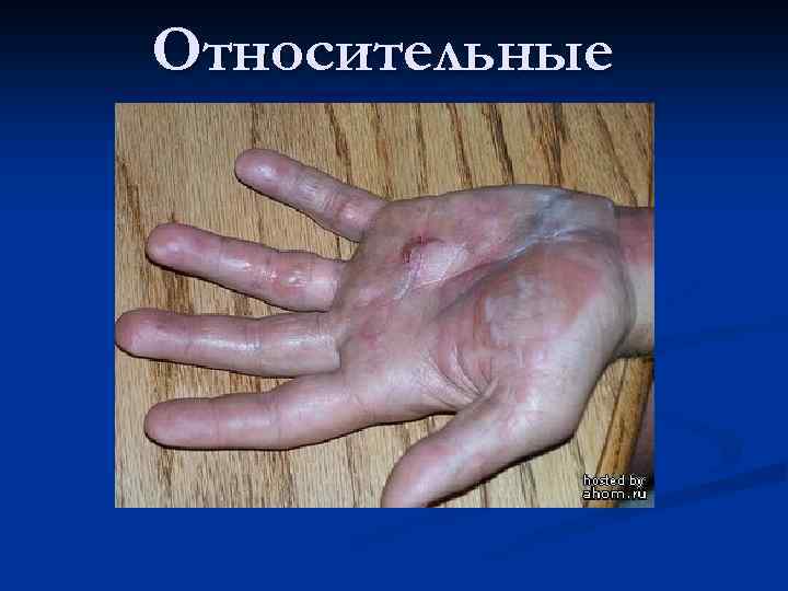 Относительные 