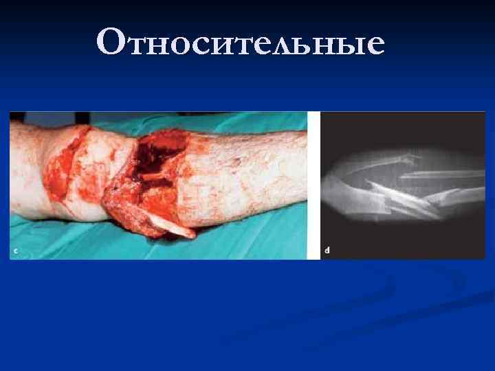 Относительные 