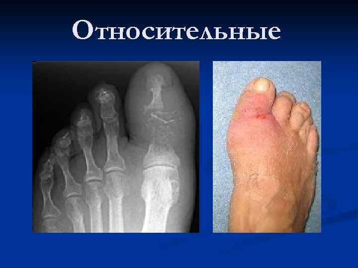 Относительные 