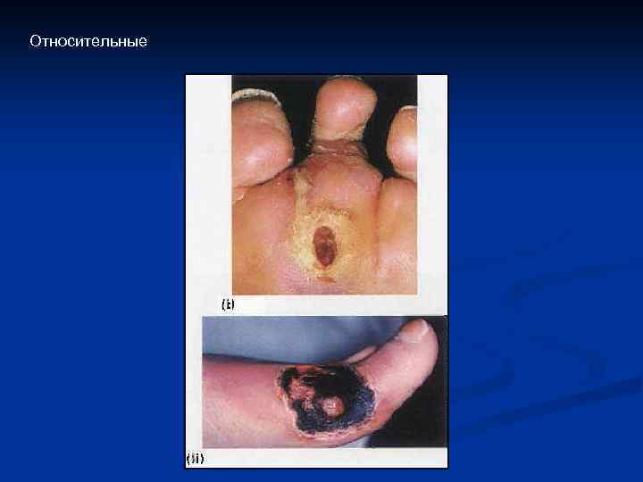 Относительные 