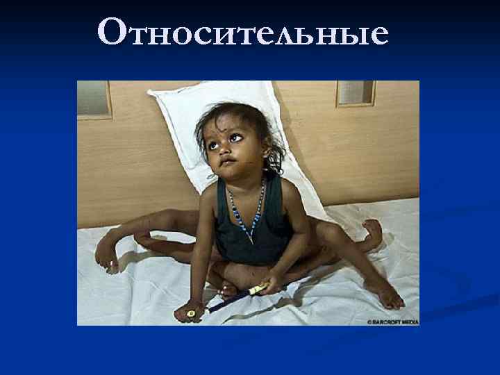 Относительные 