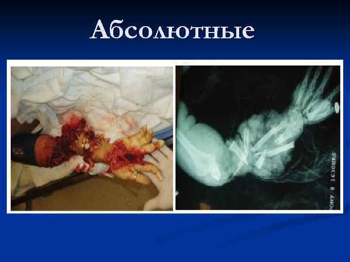 Абсолютные 