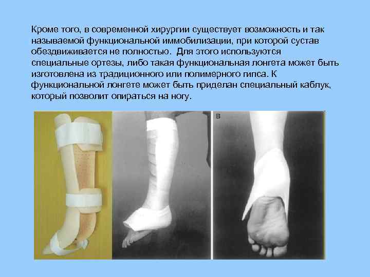 Кроме того, в современной хирургии существует возможность и так называемой функциональной иммобилизации, при которой