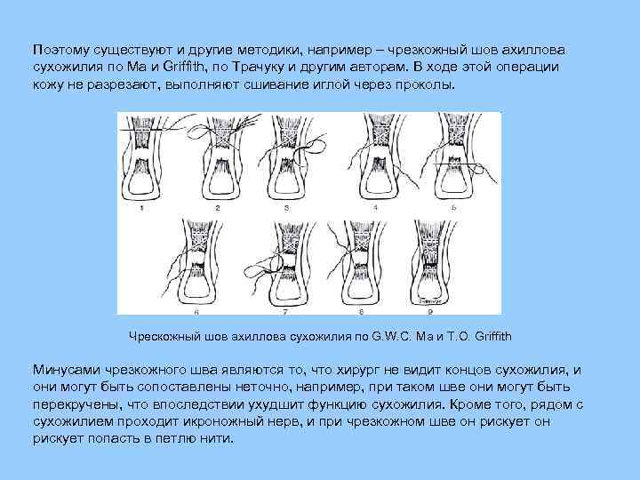 Презентация операции на сухожилиях