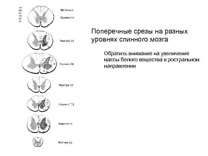 Поперечные срезы на разных уровнях спинного мозга Обратить внимание на увеличение массы белого вещества