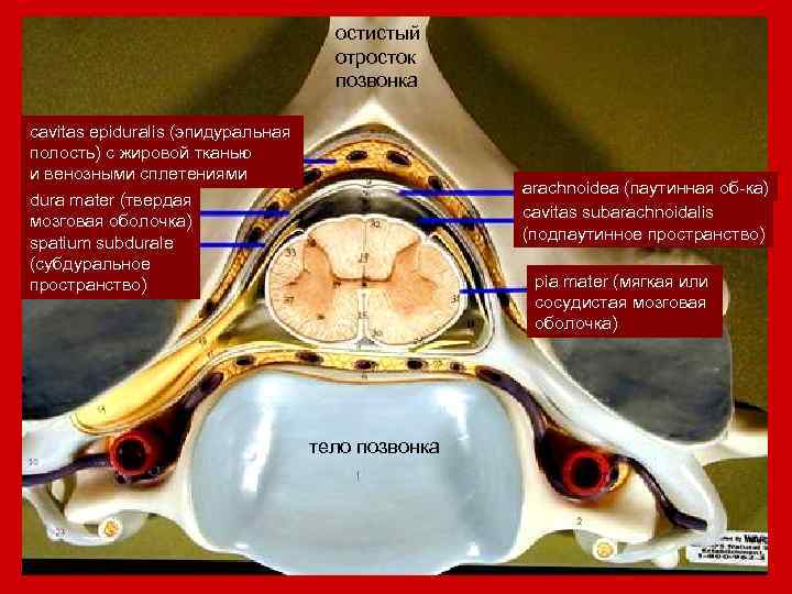 остистый отросток позвонка cavitas epiduralis (эпидуральная полость) с жировой тканью и венозными сплетениями dura