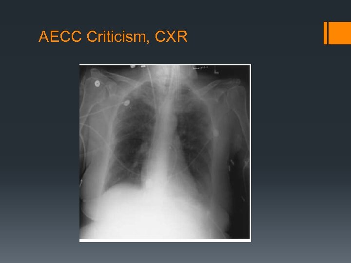 AECC Criticism, CXR 