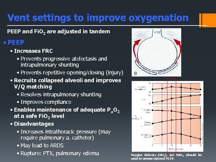 Vent settings to improve oxygenation PEEP and Fi. O 2 are adjusted in tandem