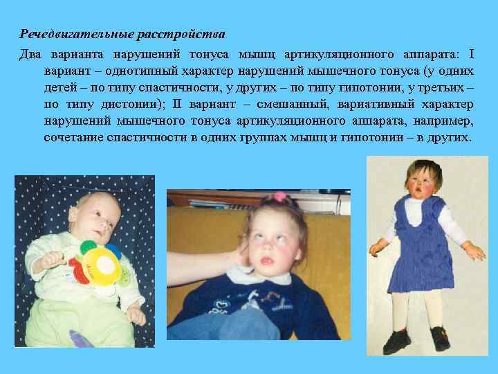 Речедвигательные расстройства Два варианта нарушений тонуса мышц артикуляционного аппарата: I вариант – однотипный характер