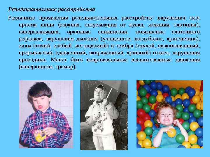 Речедвигательные расстройства Различные проявления речедвигательных расстройств: нарушения акта приема пищи (сосания, откусывания от куска,
