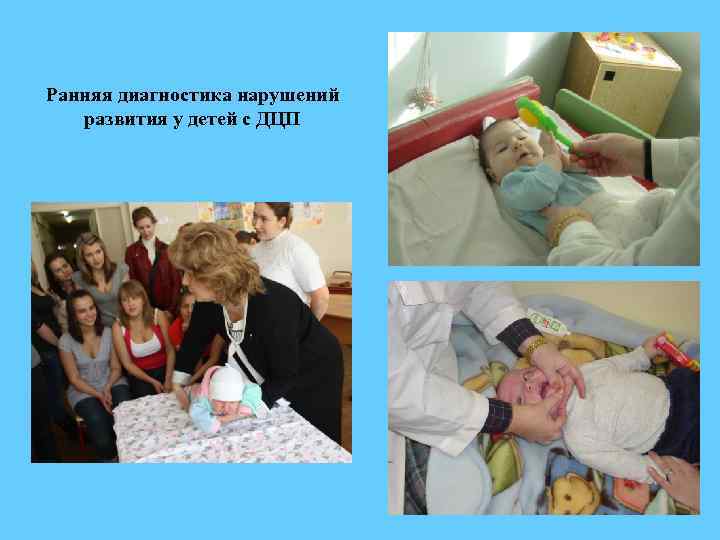 Ранняя диагностика нарушений развития у детей с ДЦП 