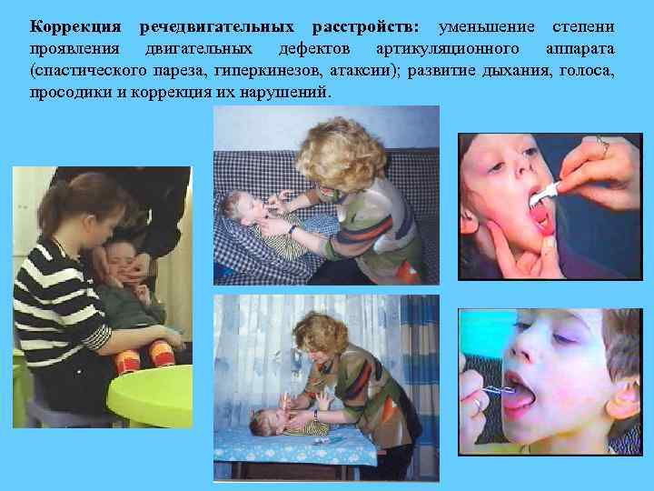 Коррекция речедвигательных расстройств: уменьшение степени проявления двигательных дефектов артикуляционного аппарата (спастического пареза, гиперкинезов, атаксии);
