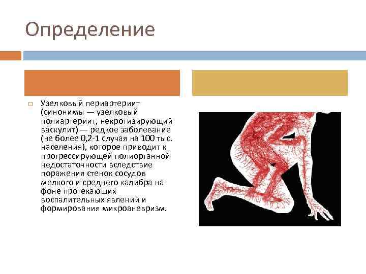 Определение Узелковый периартериит (синонимы — узелковый полиартериит, некротизирующий васкулит) — редкое заболевание (не более