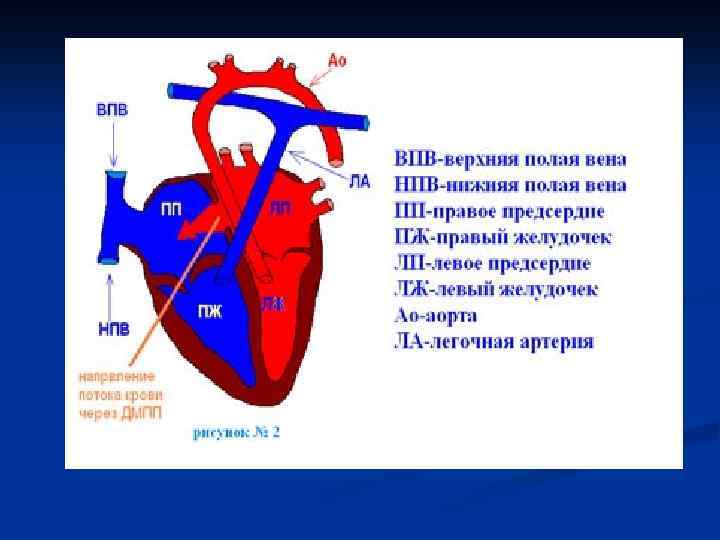 Легочная вена верхняя полая вена. Добавочная верхняя полая Вена. Заслонка нижней полой вены. Добавочная левая верхняя полая Вена. Добавочная левосторонняя верхняя полая Вена.