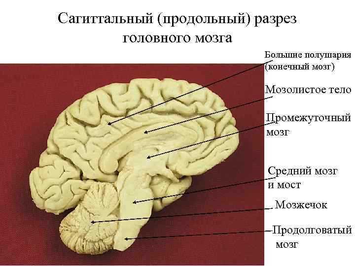 Сагиттальный (продольный) разрез головного мозга Большие полушария (конечный мозг) Мозолистое тело Промежуточный мозг Средний