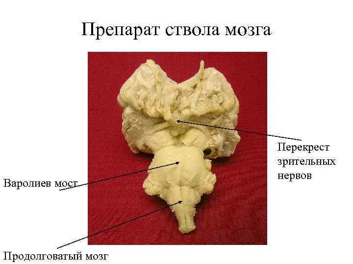 Препарат ствола мозга Варолиев мост Продолговатый мозг Перекрест зрительных нервов 