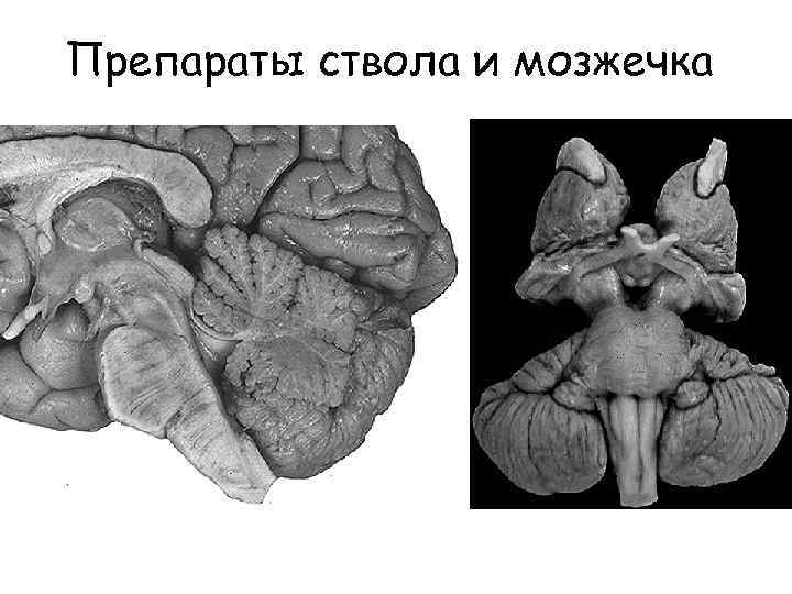 Препараты ствола и мозжечка 