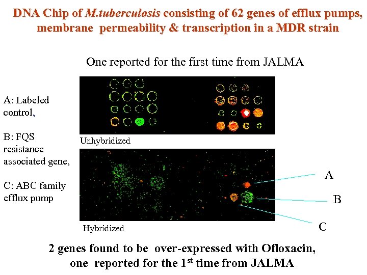 DNA Chip of M. tuberculosis consisting of 62 genes of efflux pumps, membrane permeability