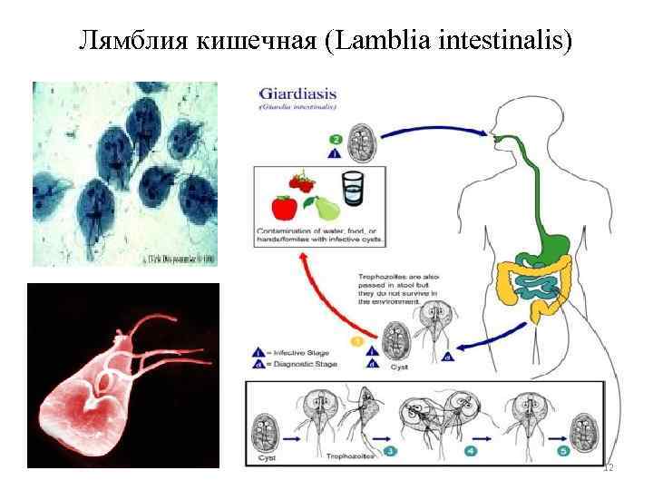 Лямблия кишечная (Lamblia intestinalis) 12 