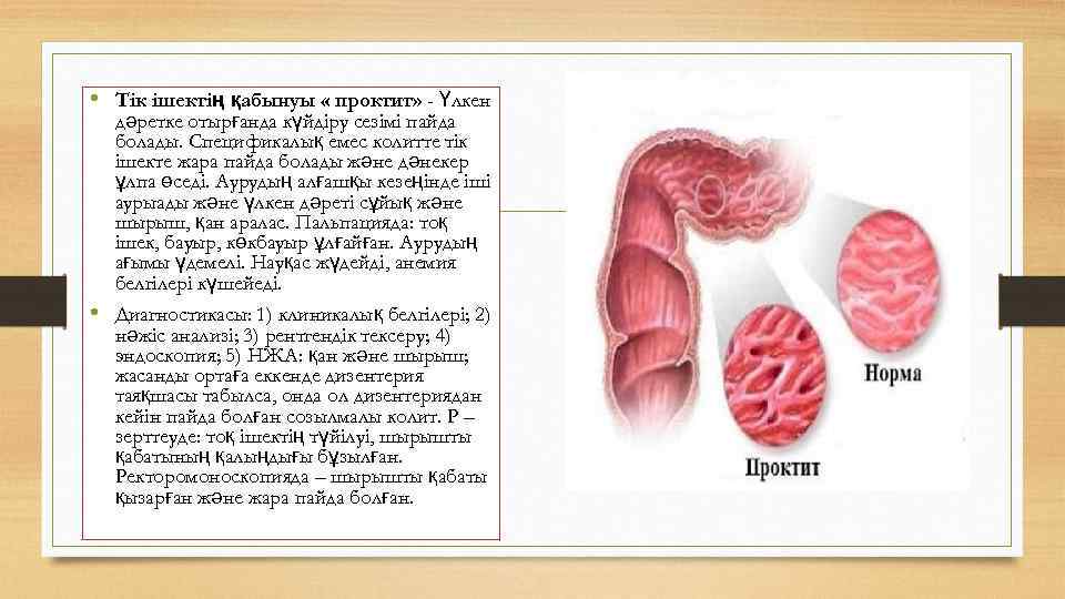  • Тік ішектің қабынуы « проктит» - Үлкен дәретке отырғанда күйдіру сезімі пайда