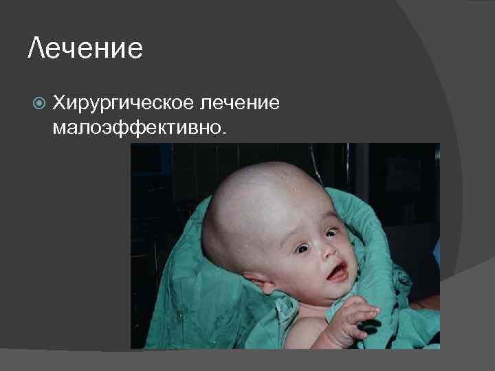 Лечение Хирургическое лечение малоэффективно. 