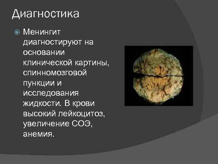 Диагностика Менингит диагностируют на основании клинической картины, спинномозговой пункции и исследования жидкости. В крови