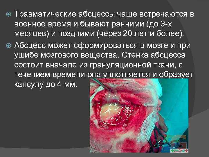 Травматические абсцессы чаще встречаются в военное время и бывают ранними (до 3 -х месяцев)
