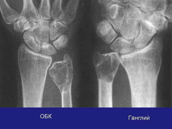 ОБК Ганглий 