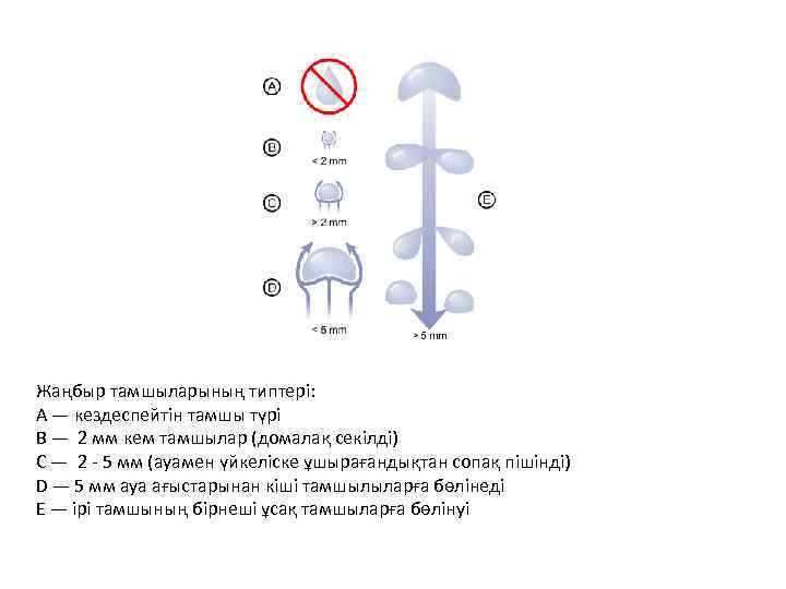 Жаңбыр тамшыларының типтері: A — кездеспейтін тамшы түрі B — 2 мм кем тамшылар