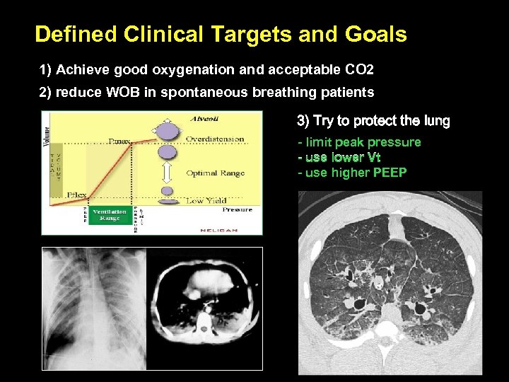 Defined Clinical Targets and Goals 1) Achieve good oxygenation and acceptable CO 2 2)