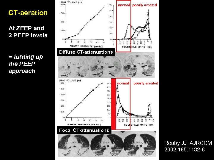 normal poorly areated CT-aeration At ZEEP and 2 PEEP levels = turning up the