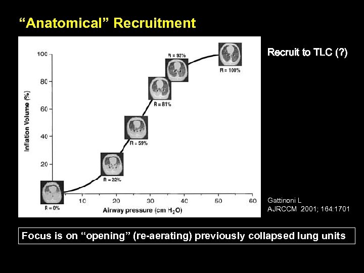 “Anatomical” Recruitment Recruit to TLC (? ) Gattinoni L AJRCCM 2001; 164: 1701 Focus