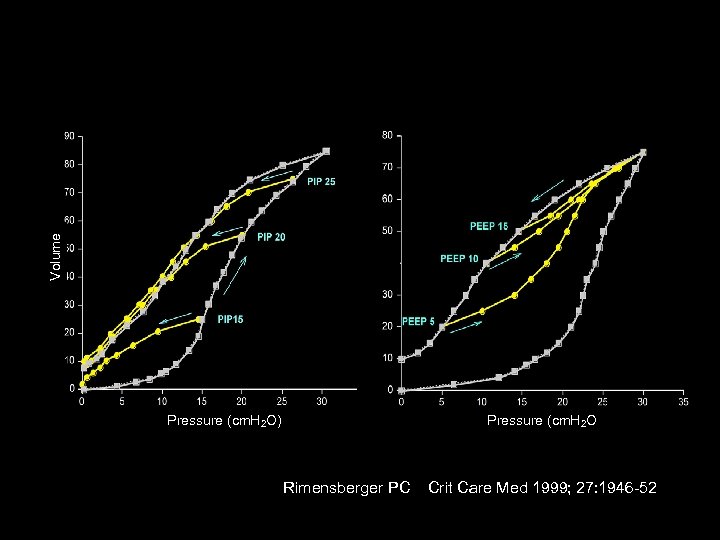 Volume 40 Pressure (cm. H 2 O) Rimensberger PC Crit Care Med 1999; 27: