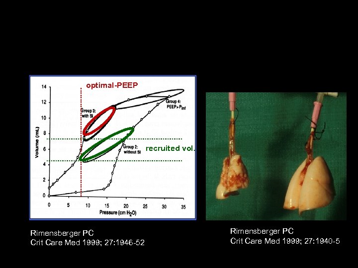 Lung recruitment: The optimal least PEEP approach optimal-PEEP recruited vol. Rimensberger PC Crit Care