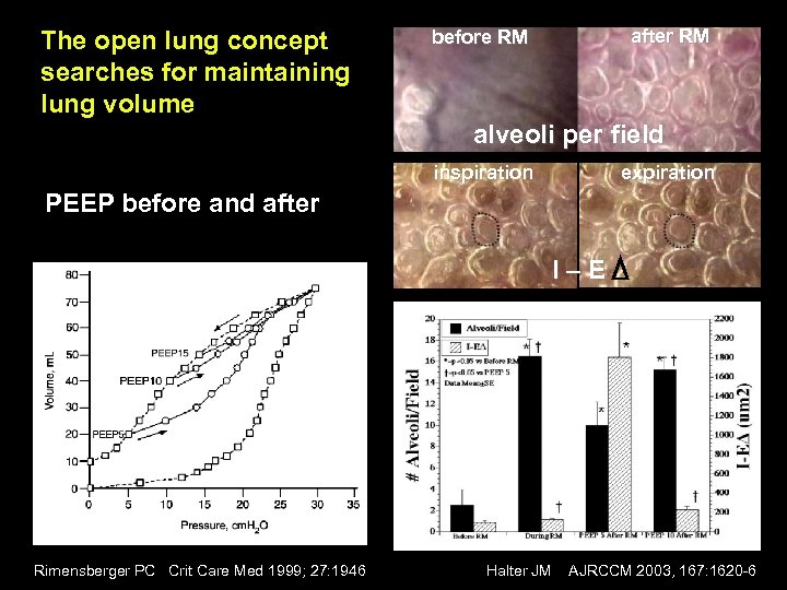 The open lung concept searches for maintaining lung volume after RM before RM alveoli