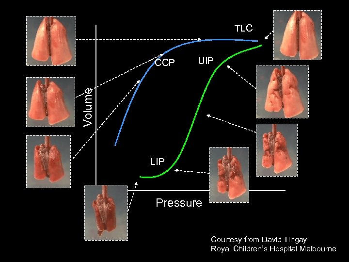 TLC UIP Volume CCP LIP Pressure Courtesy from David Tingay Royal Children’s Hospital Melbourne