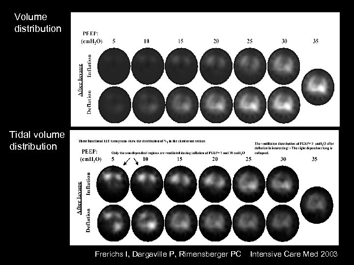 Volume distribution Tidal volume distribution Frerichs I, Dargaville P, Rimensberger PC Intensive Care Med