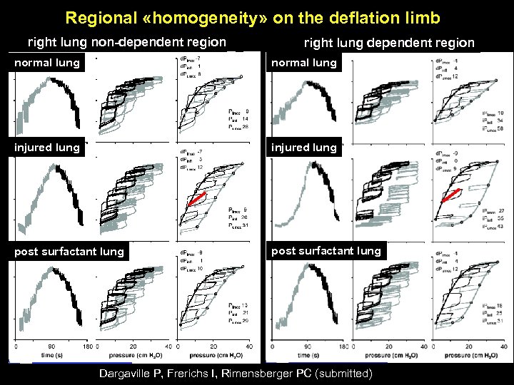 Regional «homogeneity» on the deflation limb right lung non-dependent region right lung dependent region